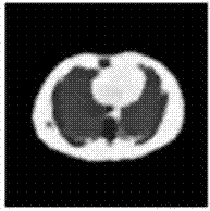 Dynamic PET (Positron Emission Tomography) image reconstruction and tracing kinetic parameter estimation method based on image segmentation