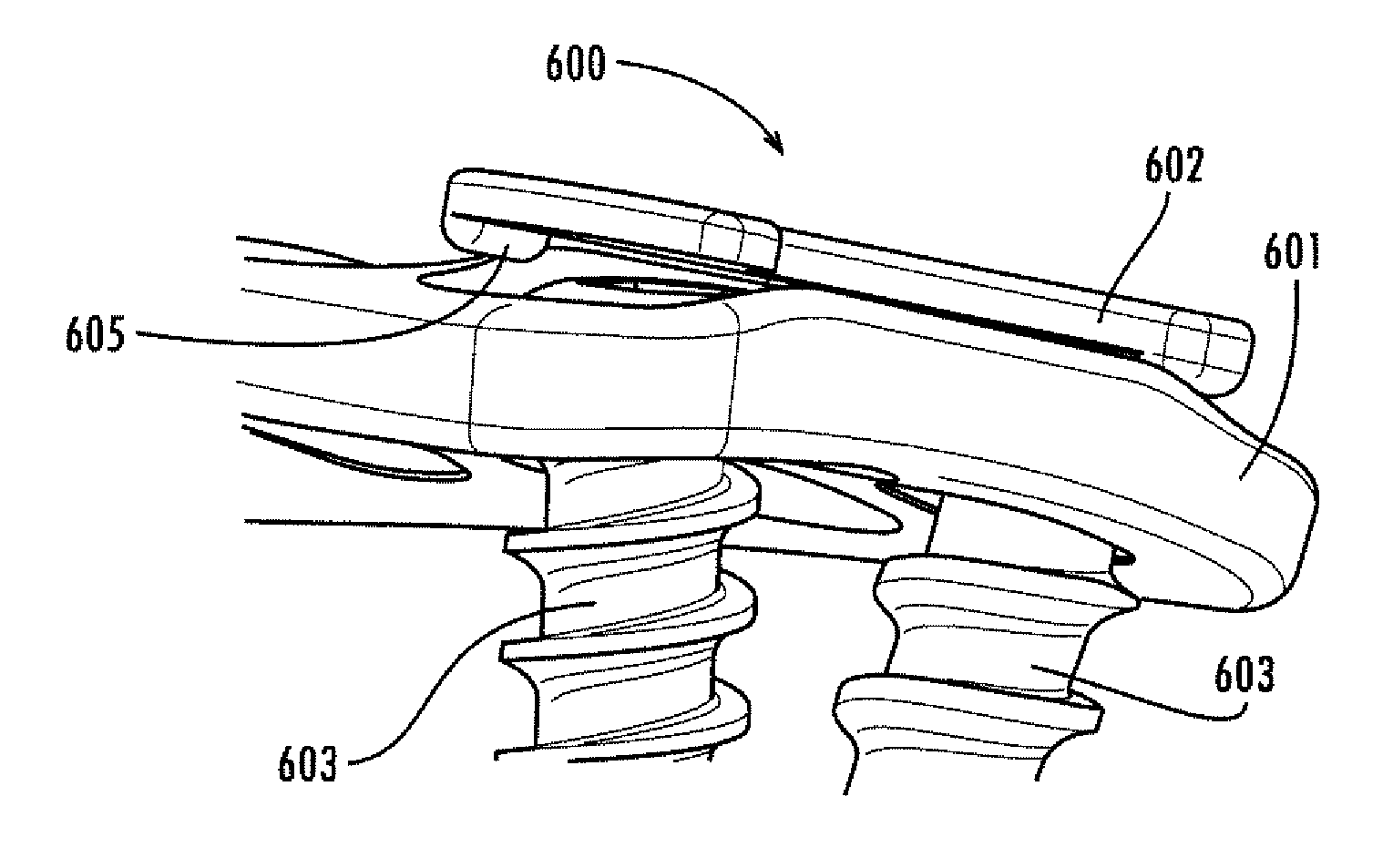 Surgical stabilization system