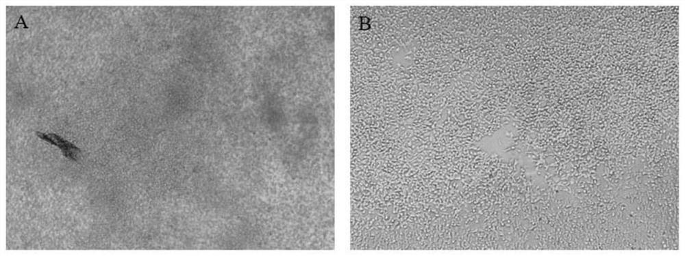 Autoimmune encephalitis antibody transient transfection and stable transfection detection method and application thereof