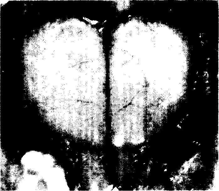 Photo-acoustic functional brain imaging method and device