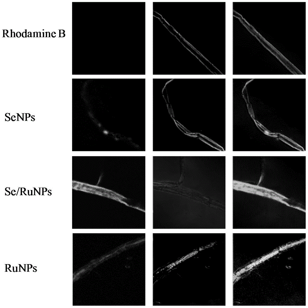 Nano-particle for inhibiting aggregation of alpha-beta and metal ions induced alpha-beta, as well as preparation and application