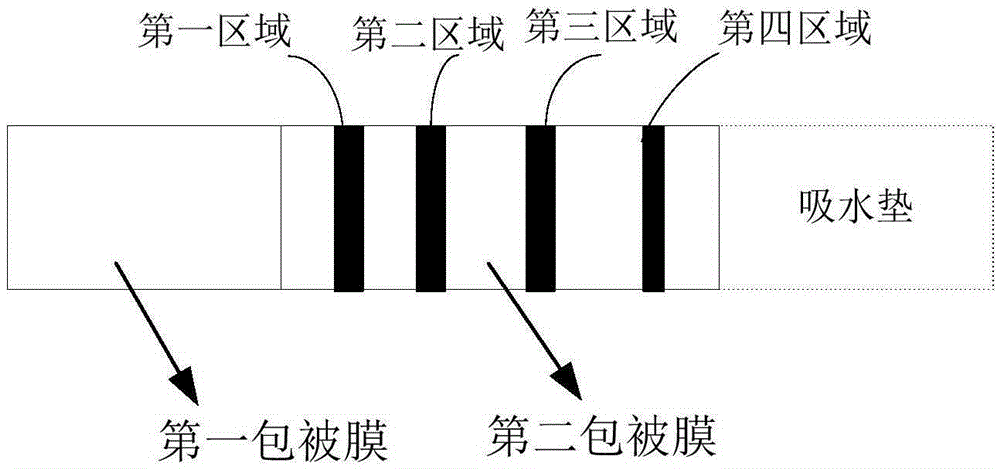 Reagent kit and method for joint detection of PCT, CRP and IL-6