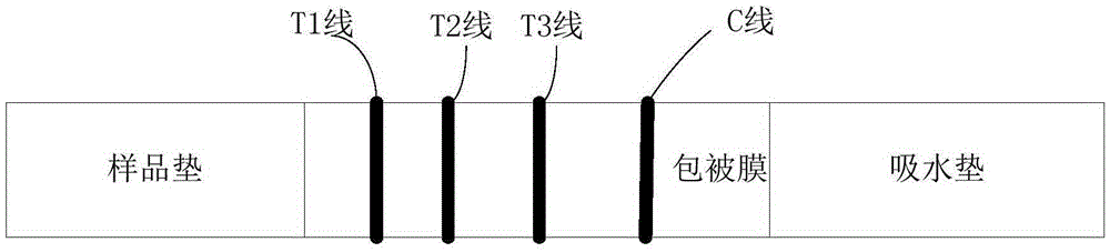 Reagent kit and method for joint detection of PCT, CRP and IL-6