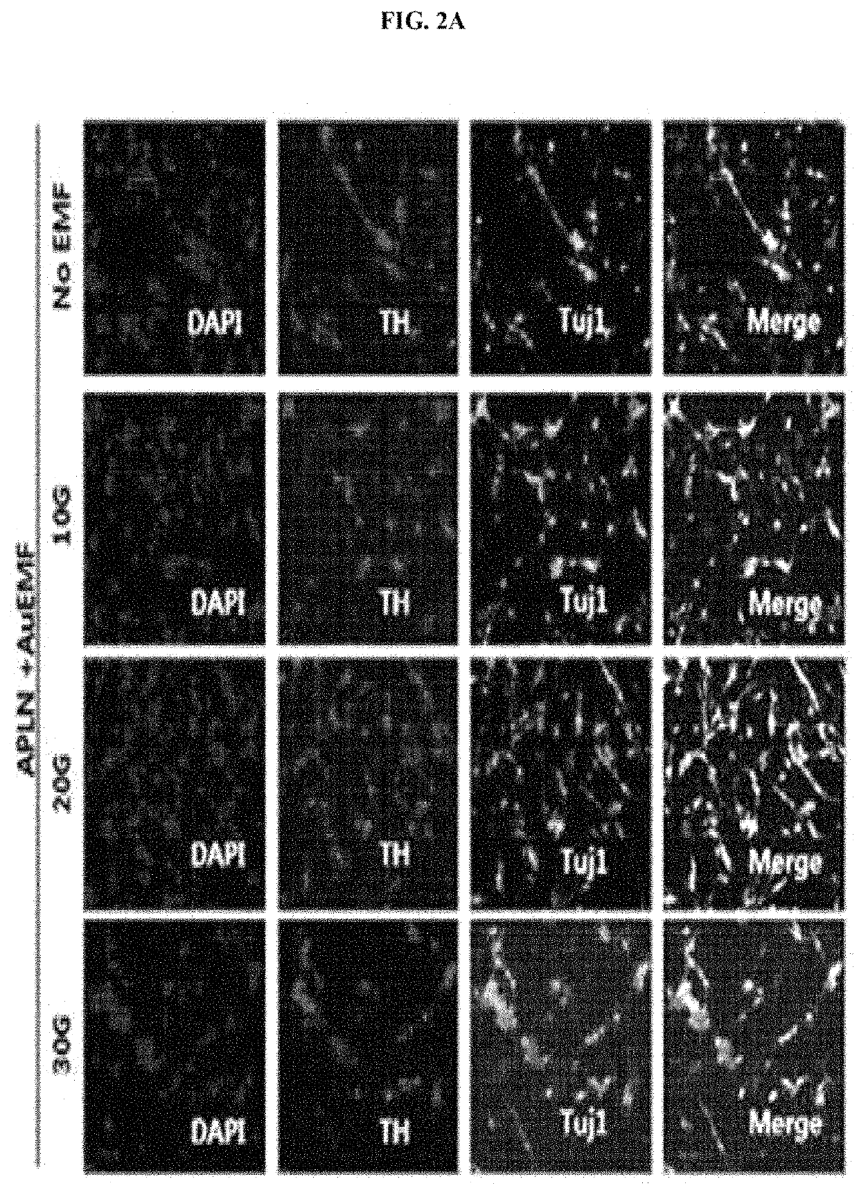 Method for direct transdifferentiation reprogramming into neurons using electromagnetic-induced metal nanoparticles