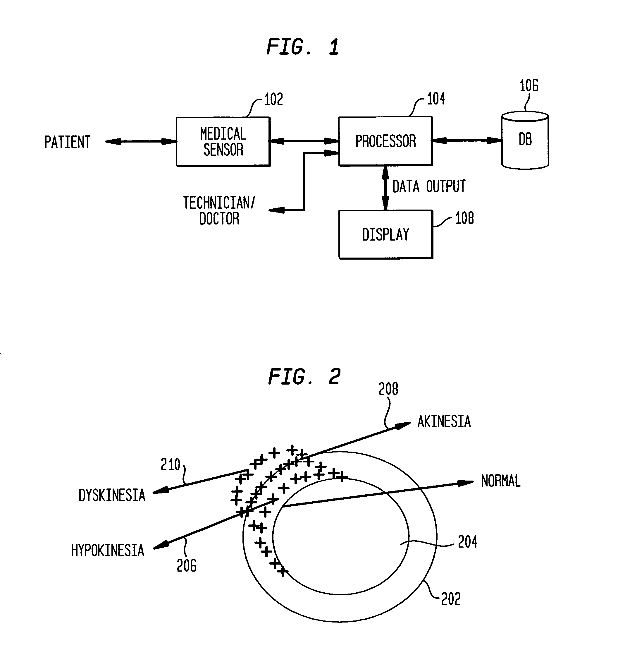 System and method for local deformable motion analysis