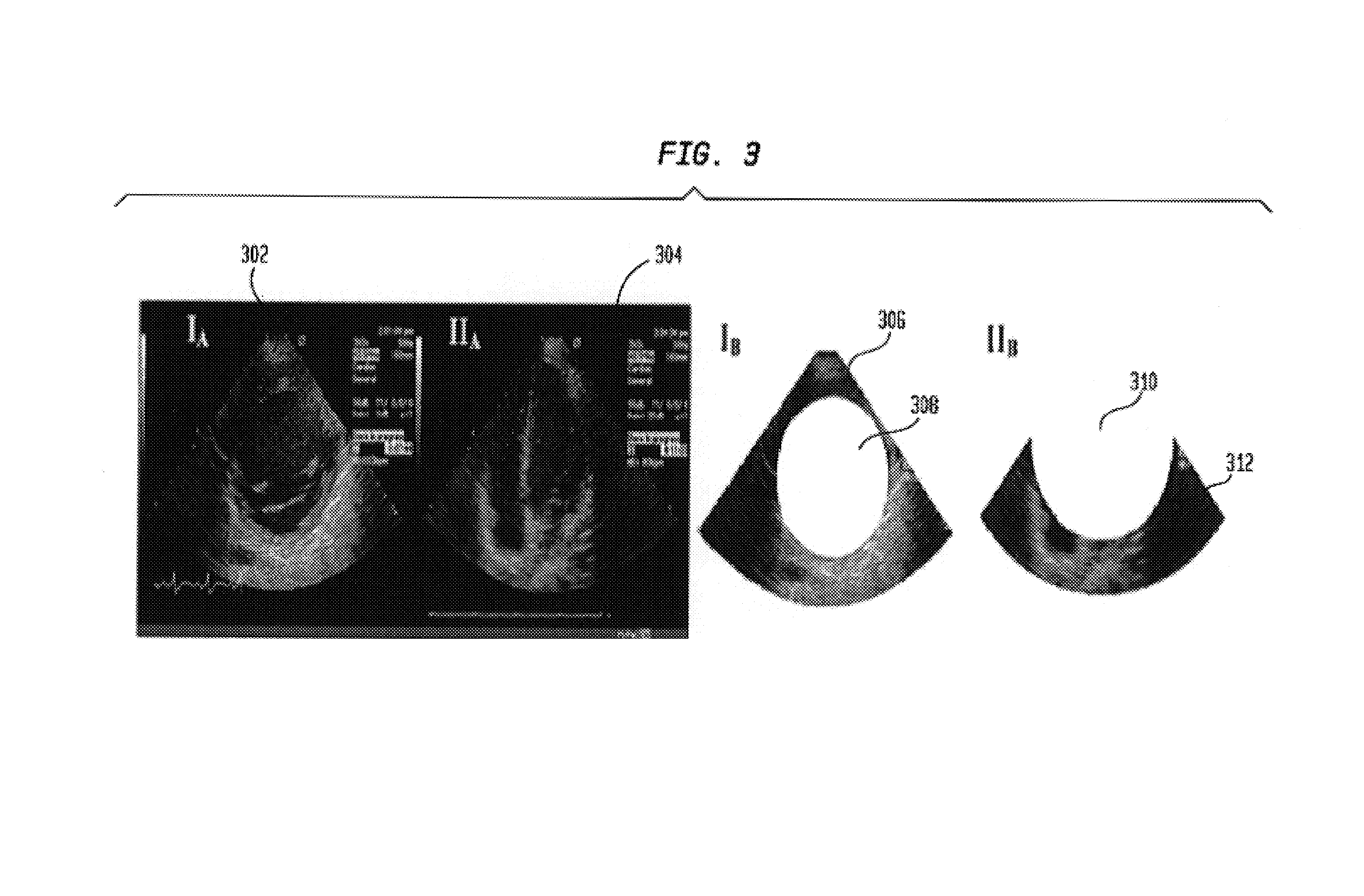 System and method for local deformable motion analysis