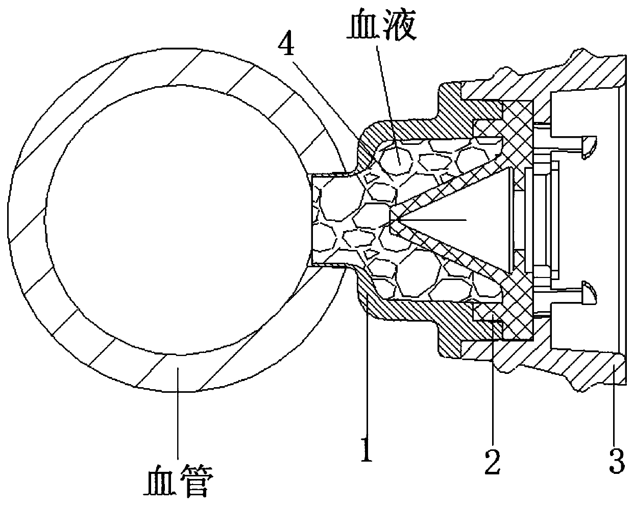 Hemostatic guide sleeve, vascular puncture device, hemostatic device and proximal anastomosis auxiliary system