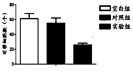 TLR4 (Toll-like receptor) compound of targeting microglia as well as preparation method and application of compound