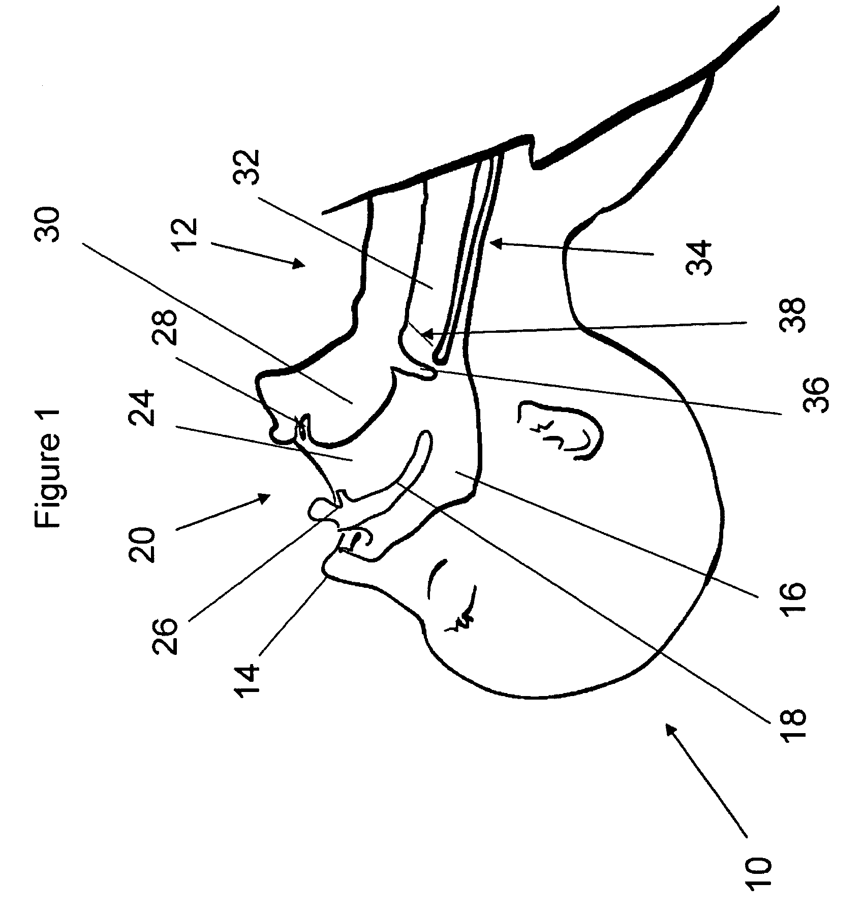 Airway intubation device