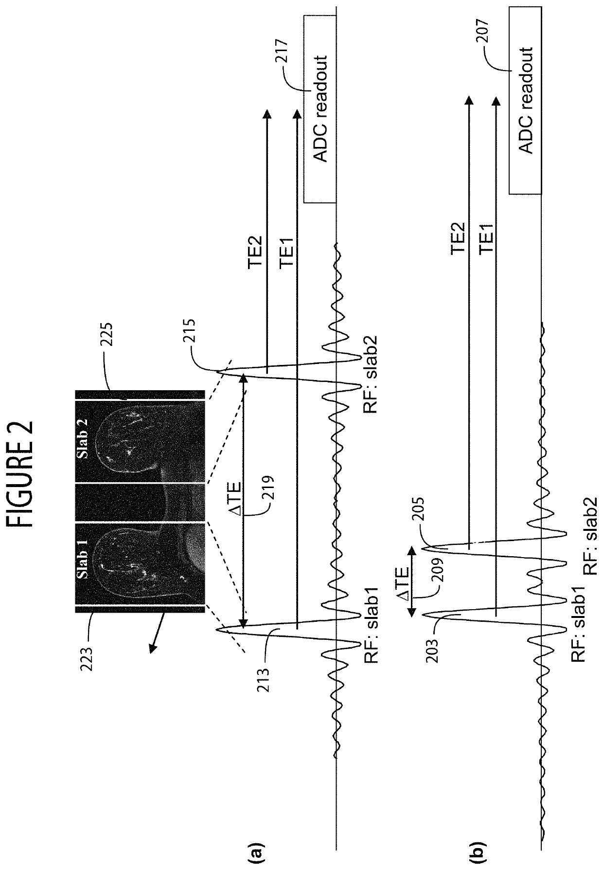 System for simultaneous dual-slab acquisition of MR images with asymmetric and time-reversed asymmetric, concatenated pulses