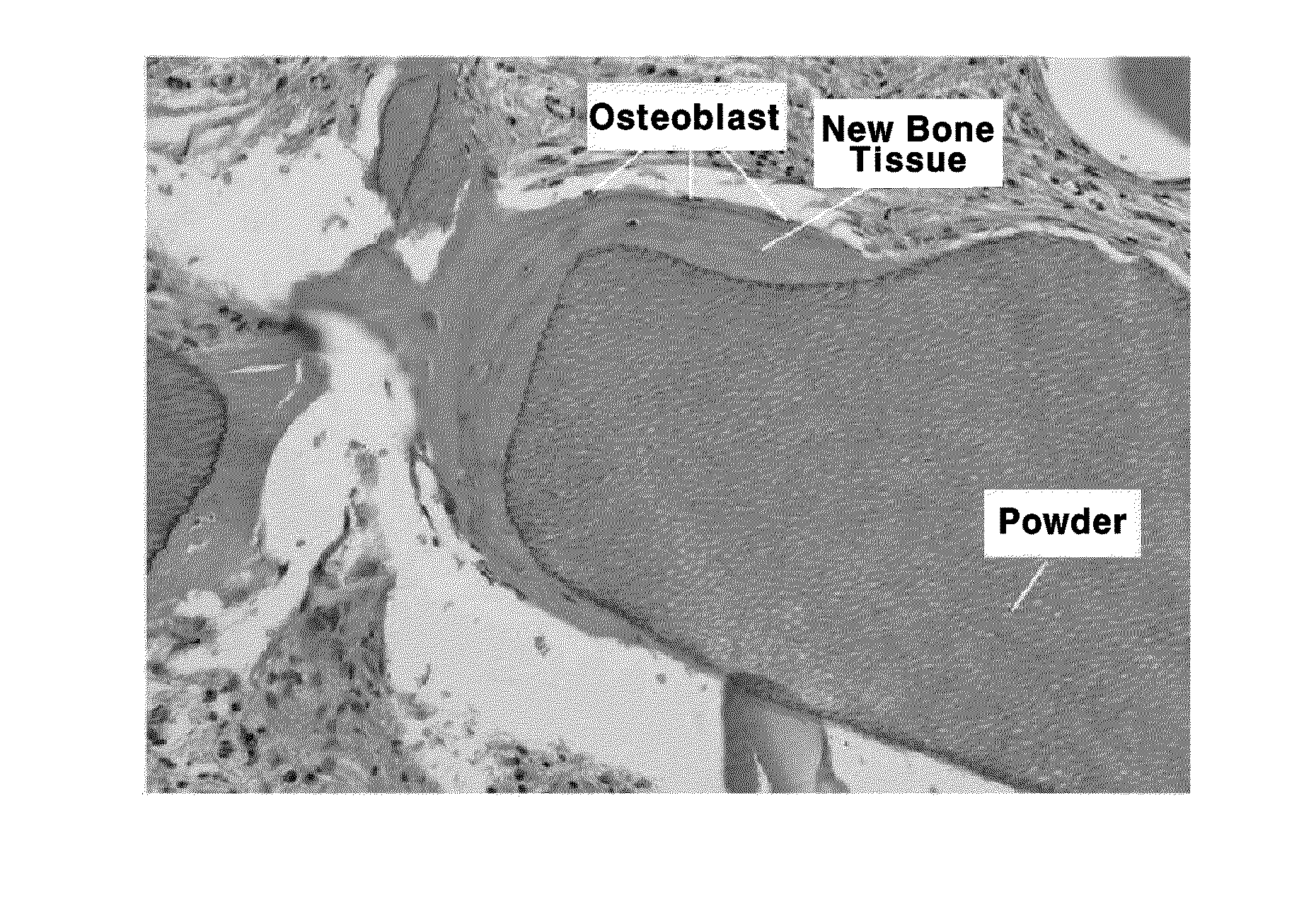 Method for processing bone graft material using teeth, and bone graft material processed thereby