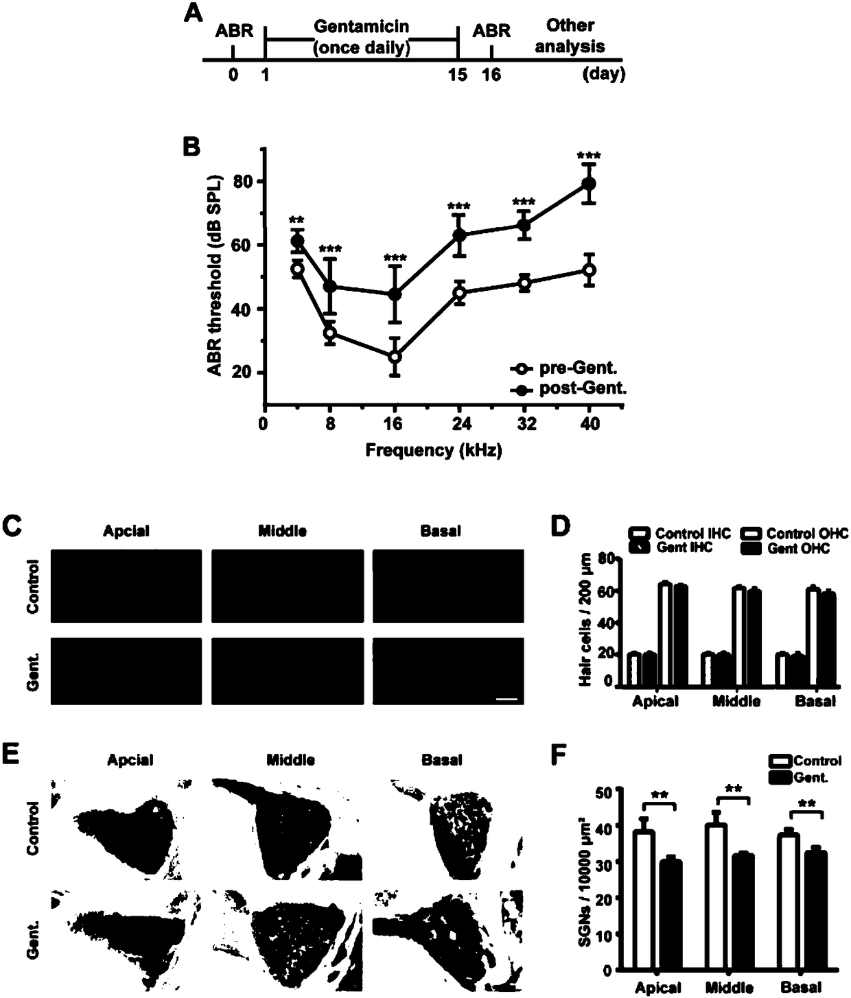 Application of mTOR signal path inhibitor to preparation of medicament for preventing or treating extragenetic hearing impairment