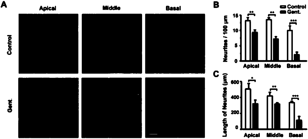 Application of mTOR signal path inhibitor to preparation of medicament for preventing or treating extragenetic hearing impairment