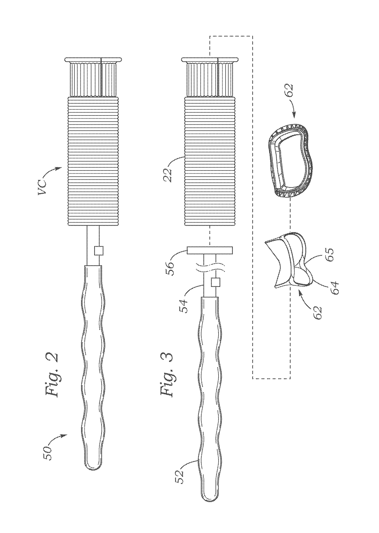 Methods of assembling a valved aortic conduit