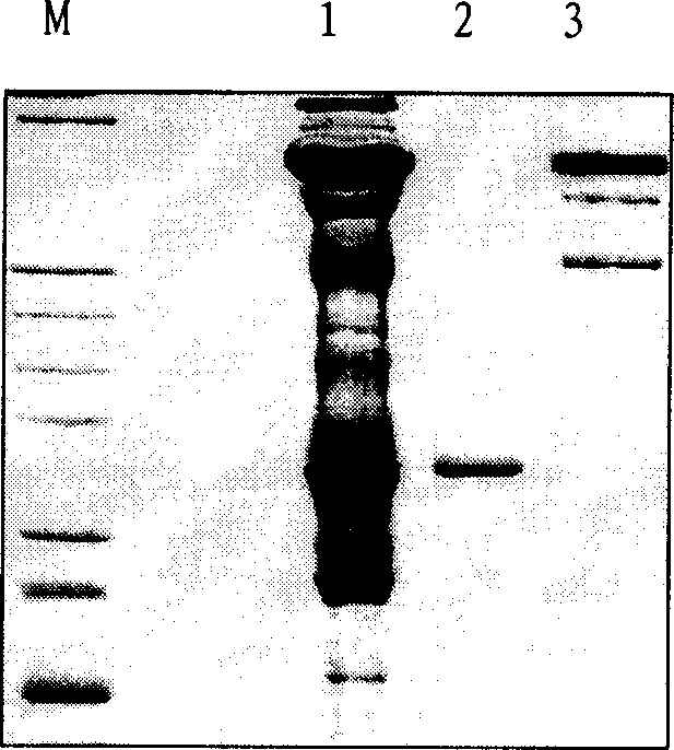 HAb18Gedomab 1 monoclonal antibody and its light and heavy chain variable area genes, coding polypeptide and use