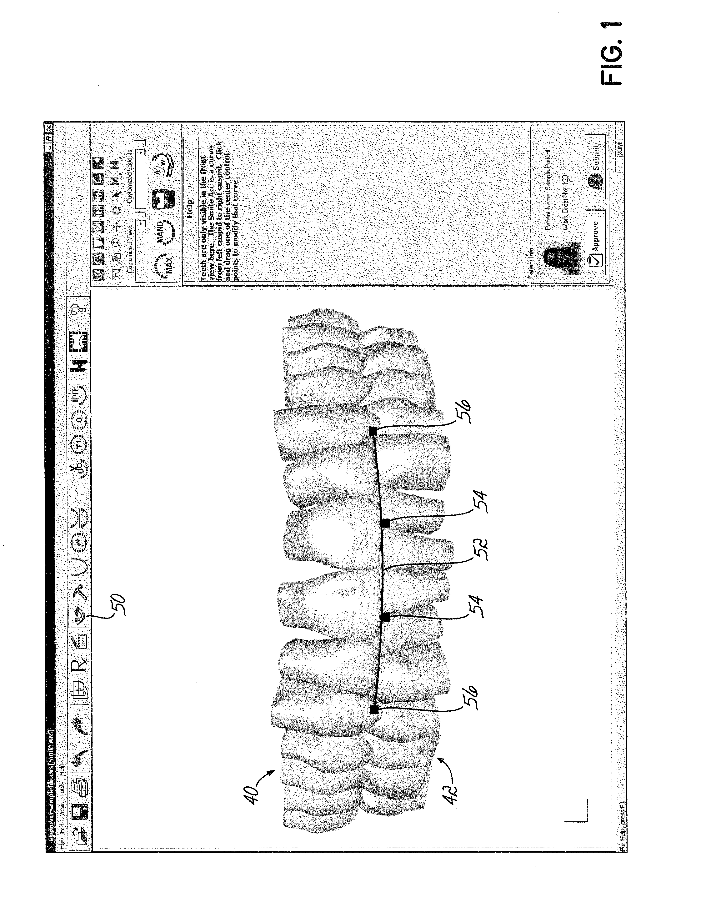 Software and methods for dental treatment planning