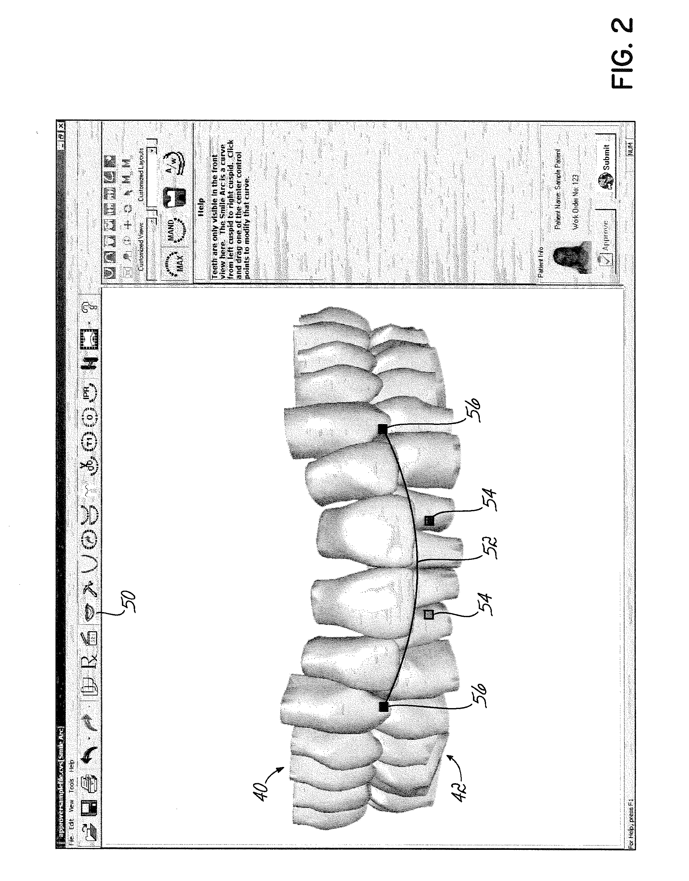 Software and methods for dental treatment planning