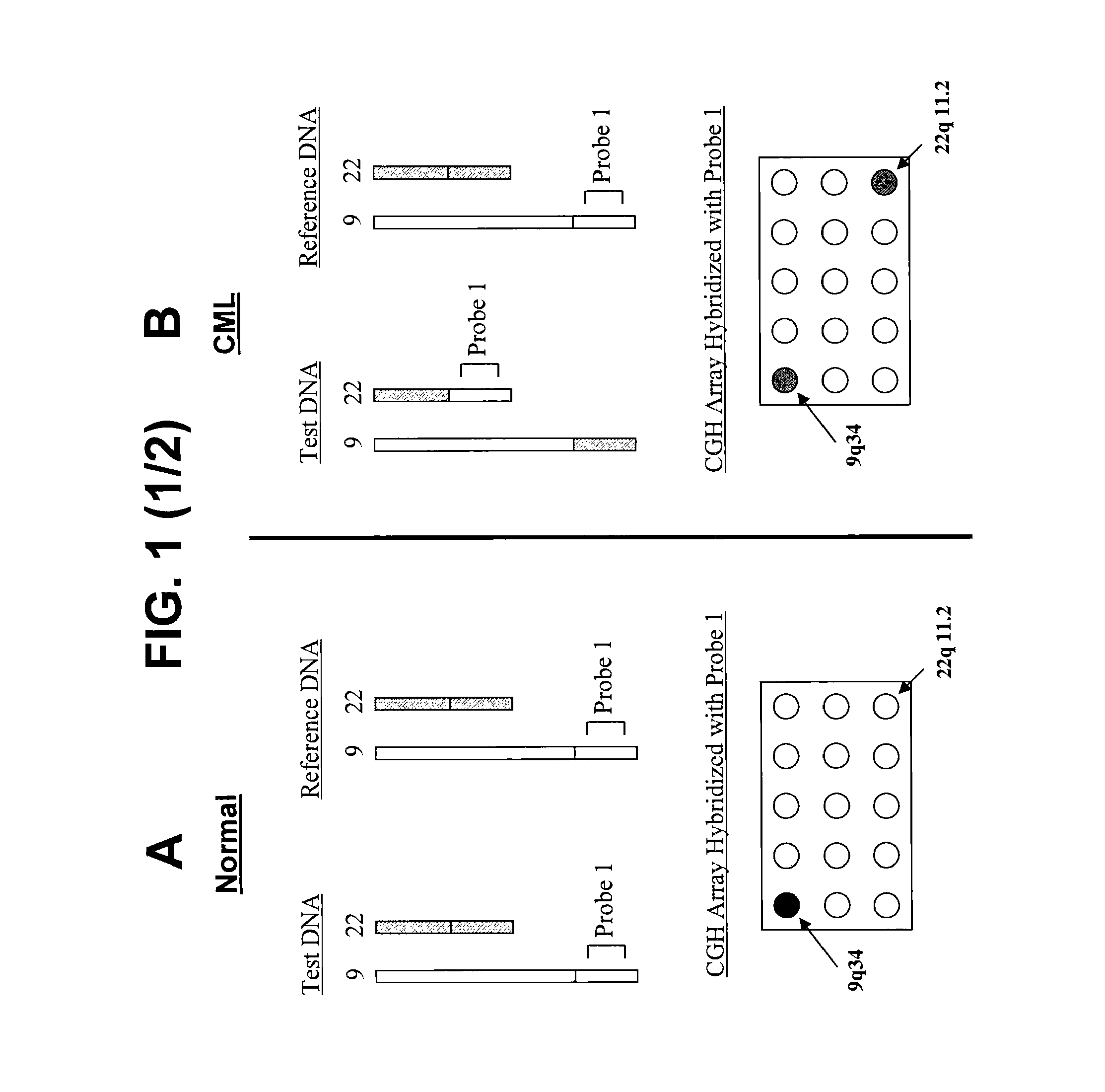 Balanced translocation in comparative hybridization