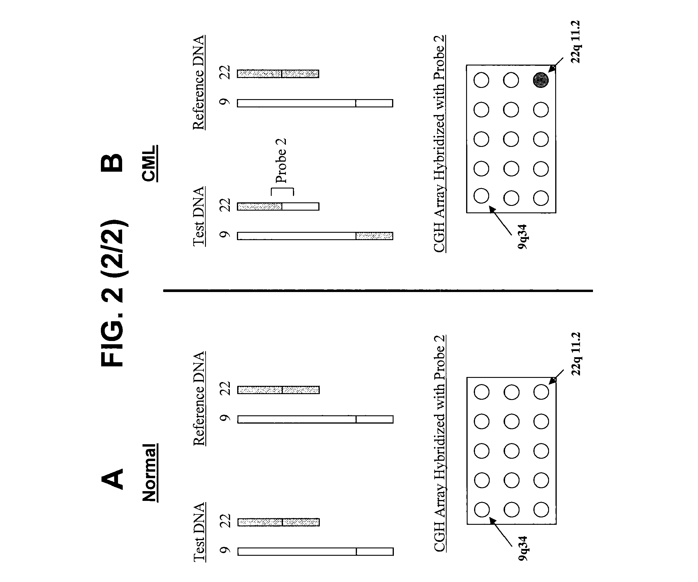 Balanced translocation in comparative hybridization