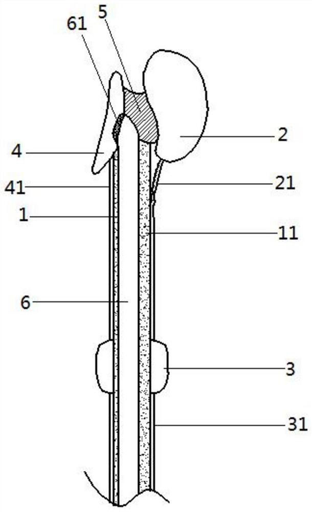 Stent for esophageal ultrasound probe