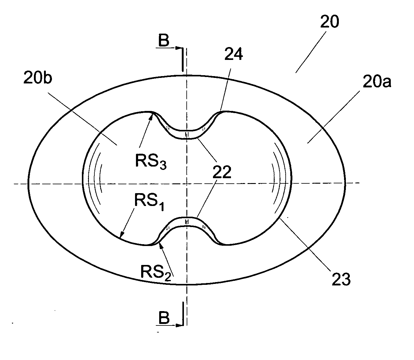 Universal disc prosthesis