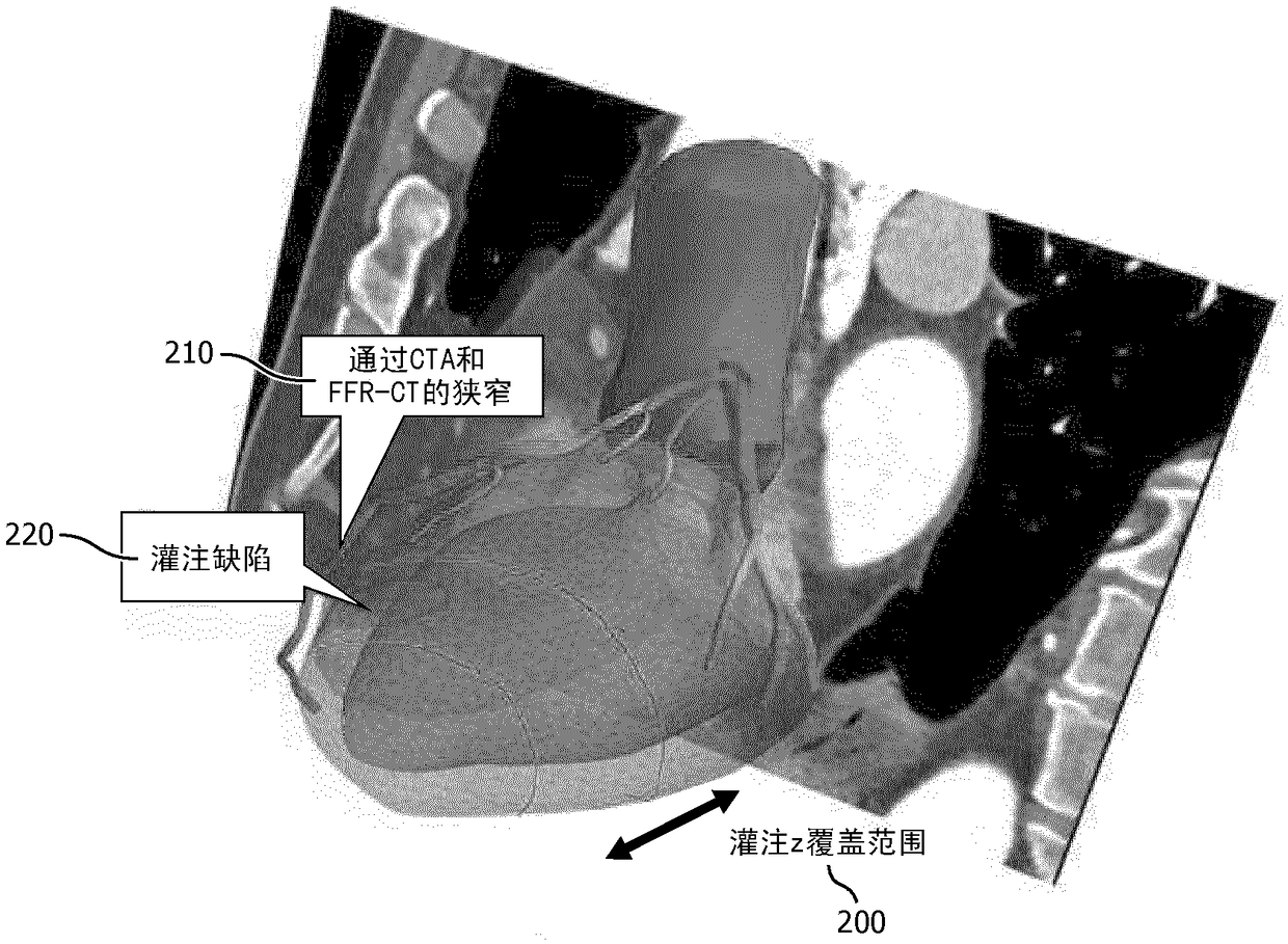 CT perfusion protocol targeting