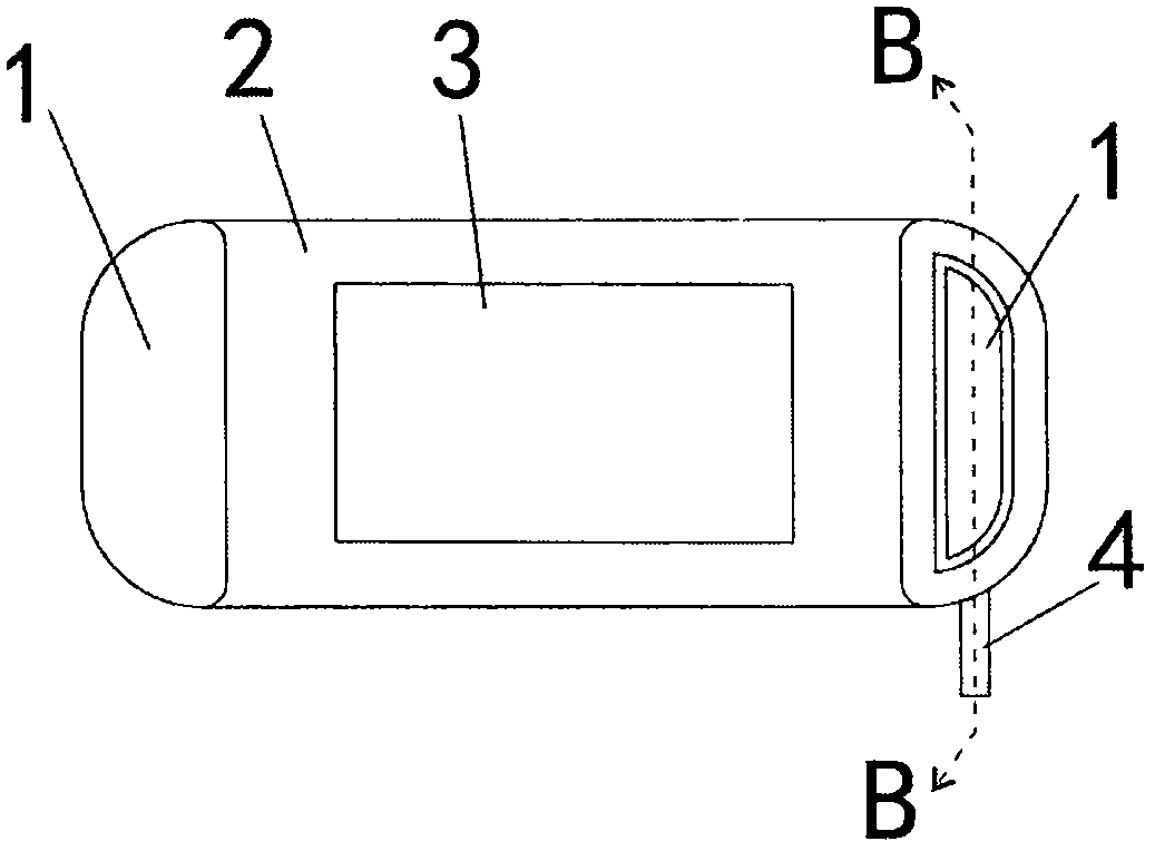 Adjustable contraceptive retaining ring