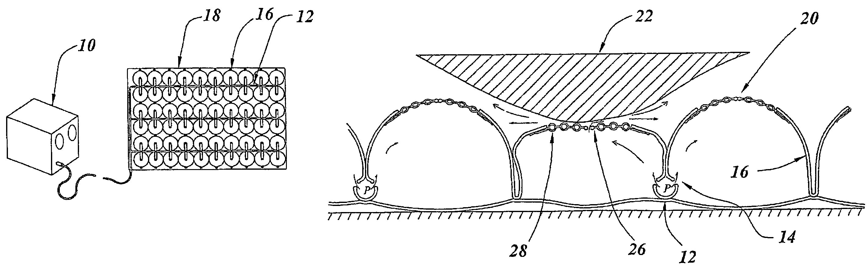 Inflatable decubitis mat with vent structures controlled by heat sensors