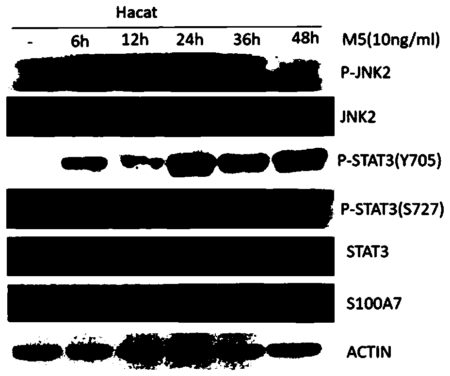 Use of Worenine as JNK2 Kinase Inhibitor and Treatment of Psoriasis