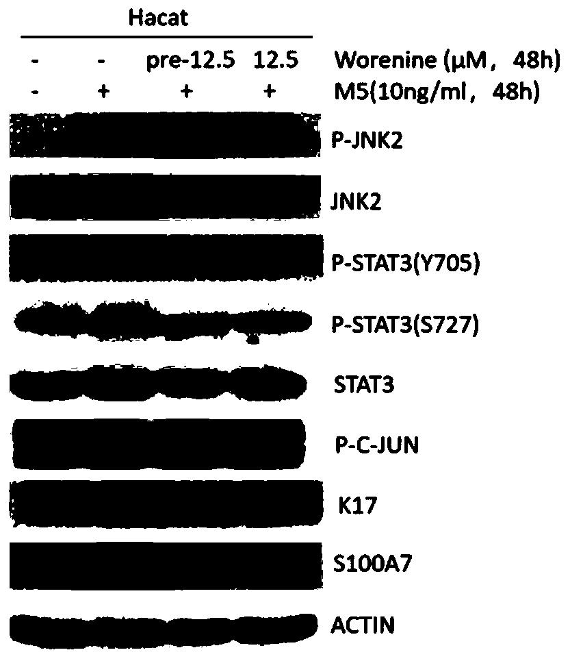 Use of Worenine as JNK2 Kinase Inhibitor and Treatment of Psoriasis