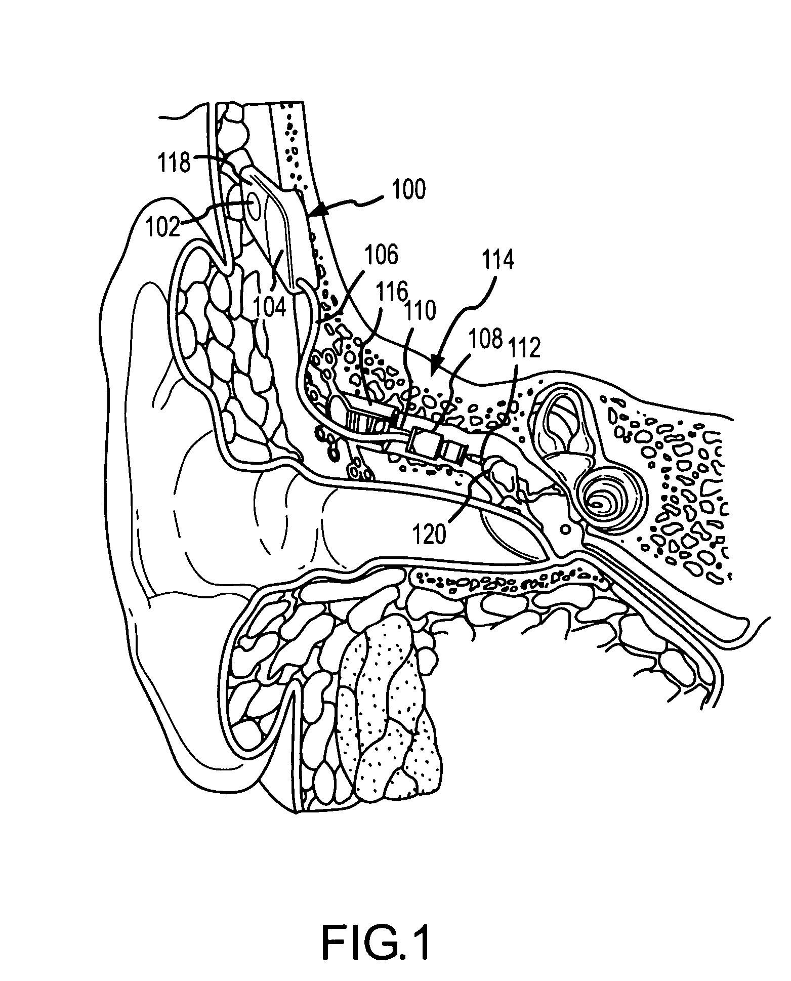 Method for obtaining diagnostic information relating to a patient having an implanted transducer