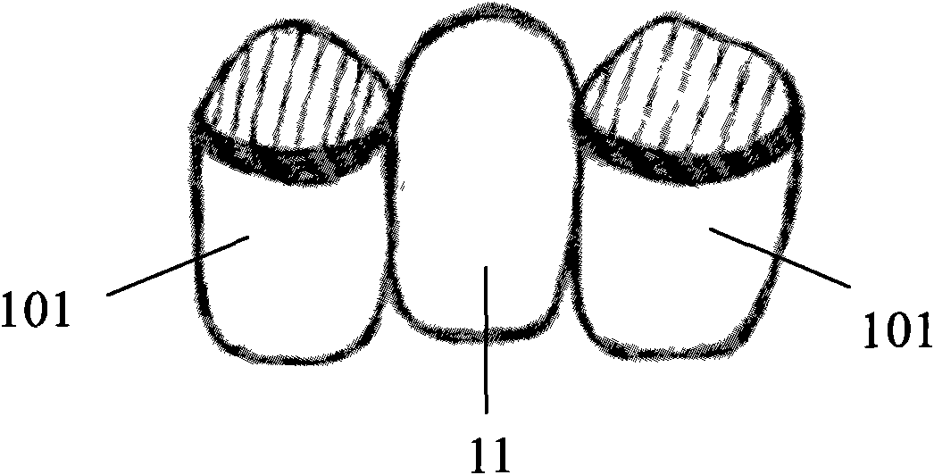 Zirconium dioxide full porcelain tooth and preparation method thereof