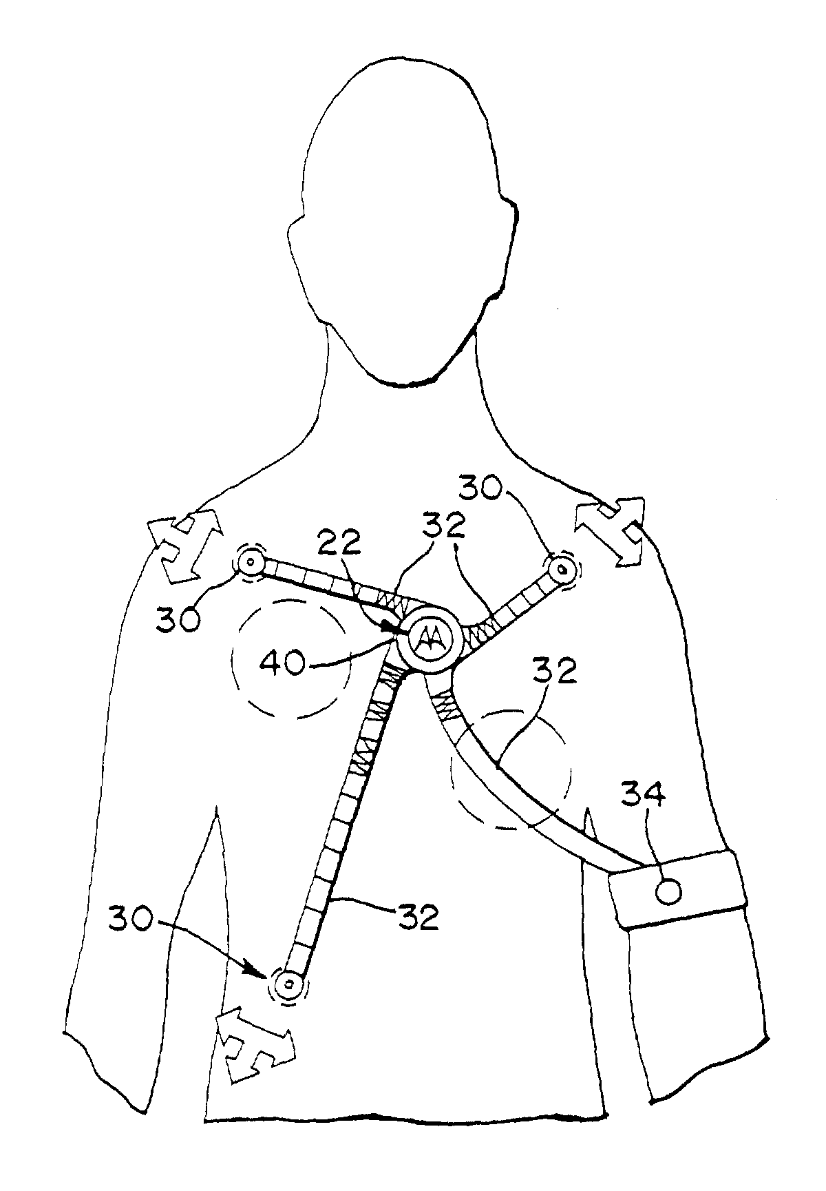 Wireless electrocardiograph system and method