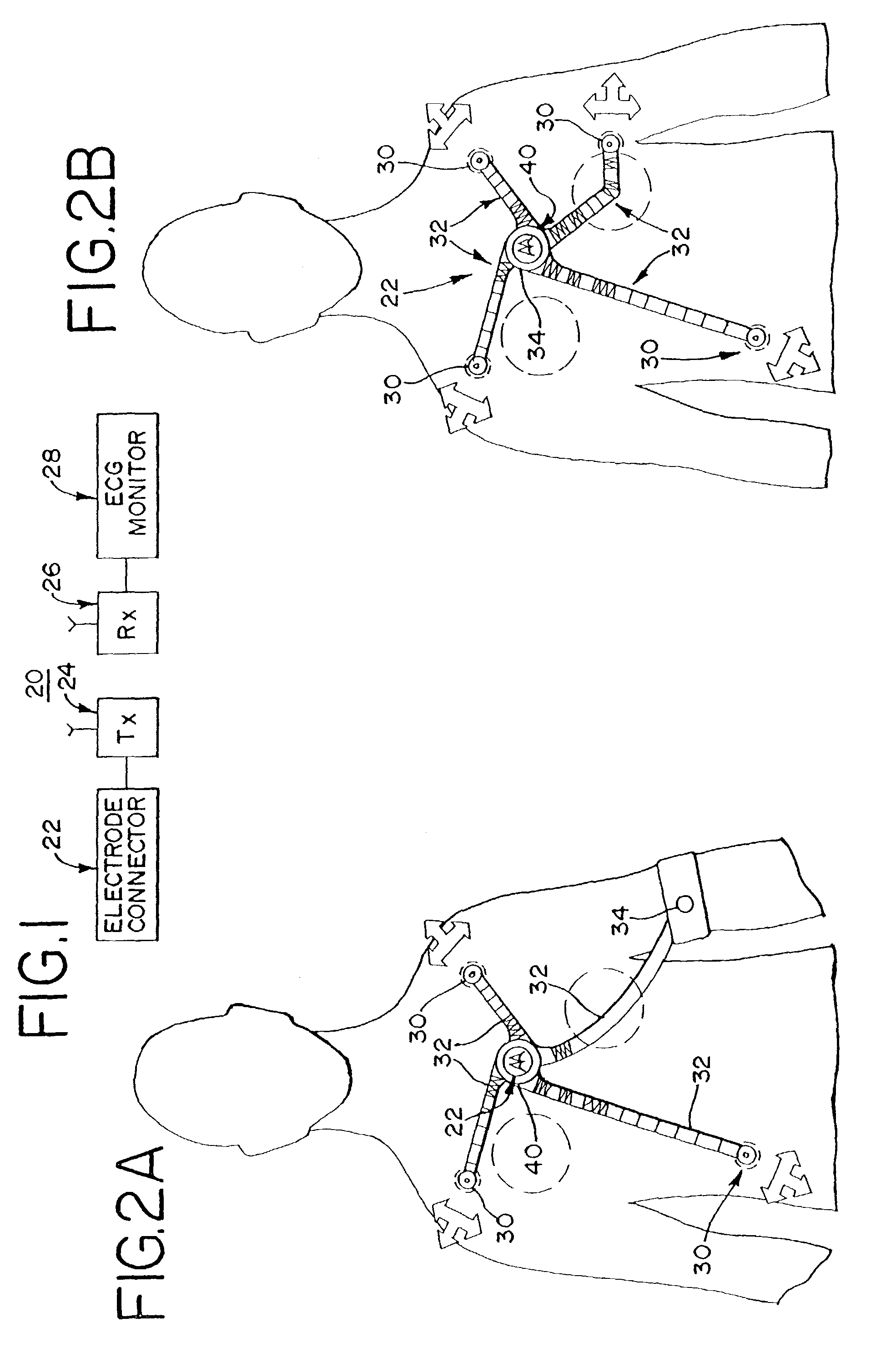 Wireless electrocardiograph system and method