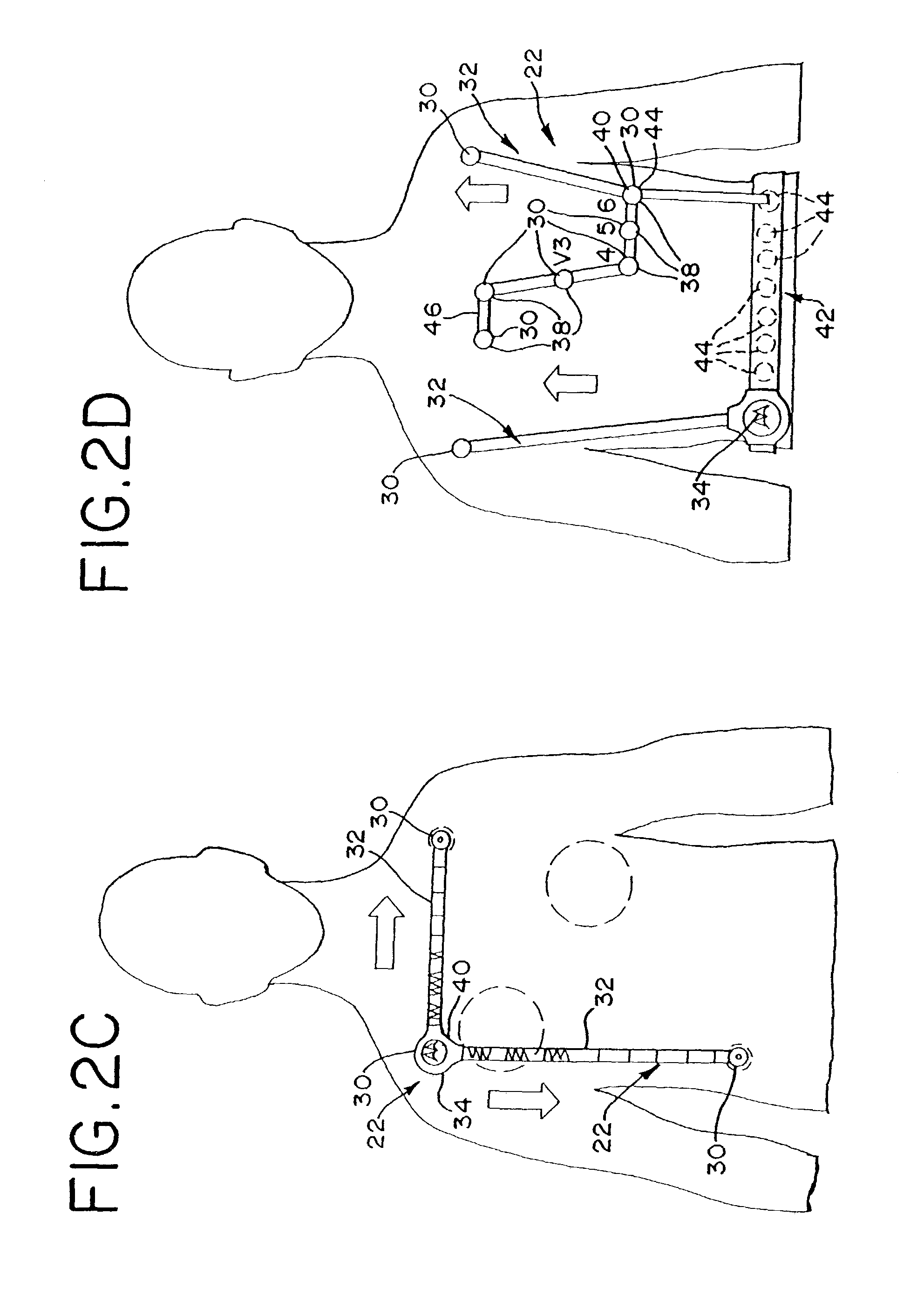 Wireless electrocardiograph system and method