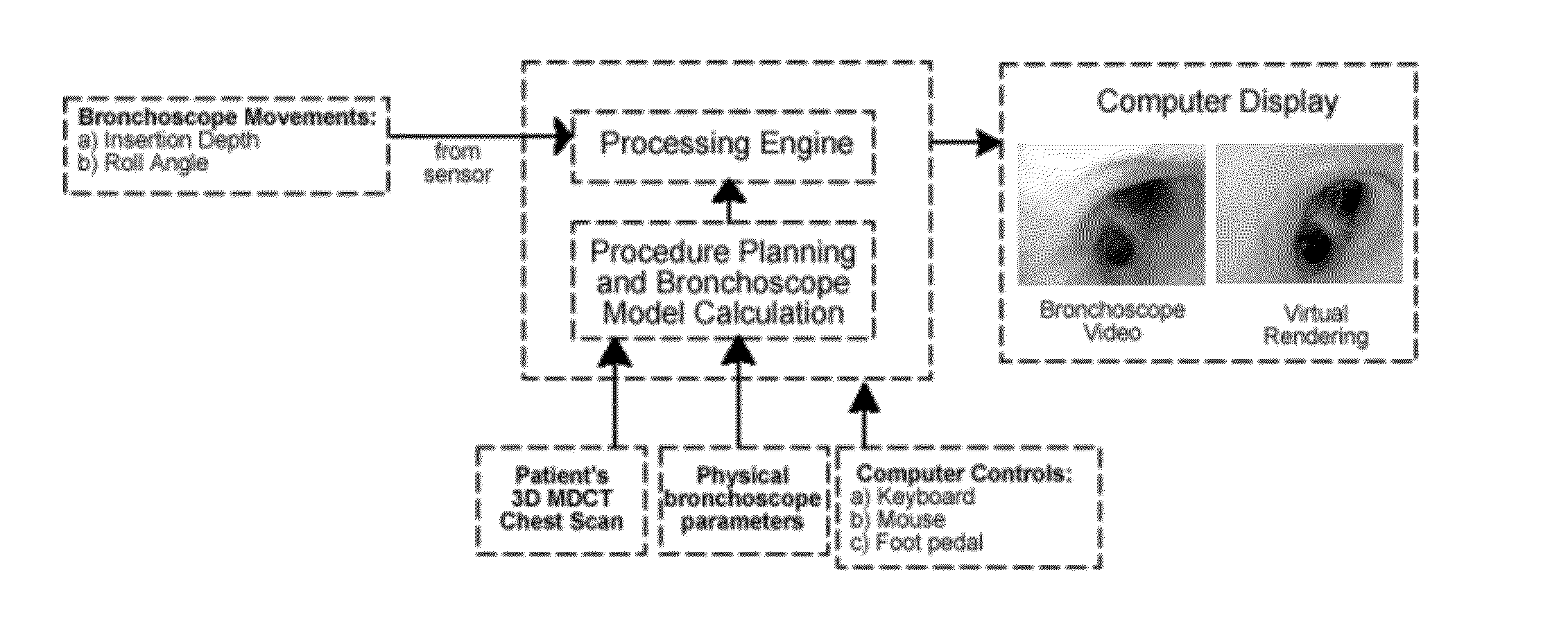 Method and device for determining the location of an endoscope