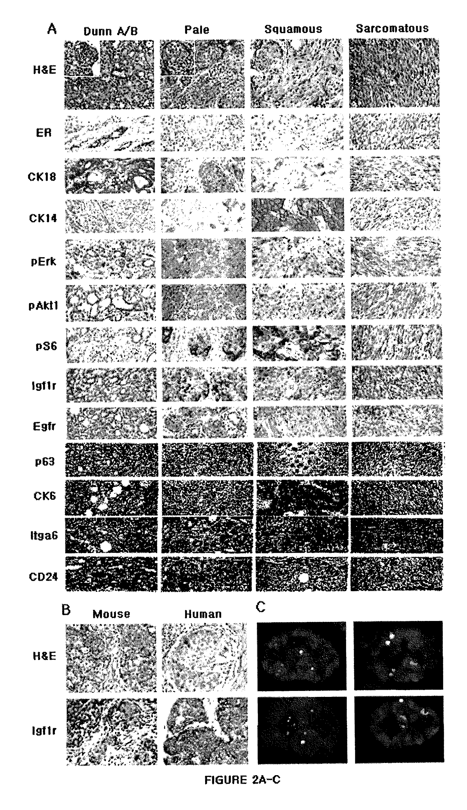 Analogues of (-)-picropodophyllin, synthesis and uses thereof