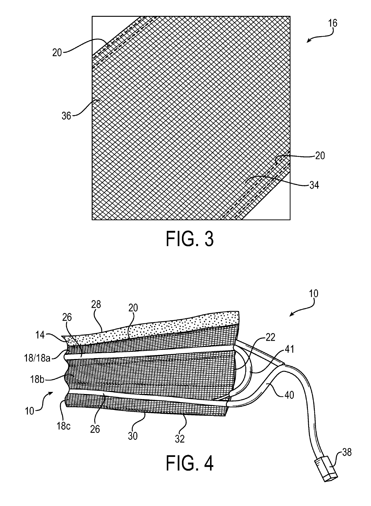 Wrapped hose heater assembly with hot pocket configuration