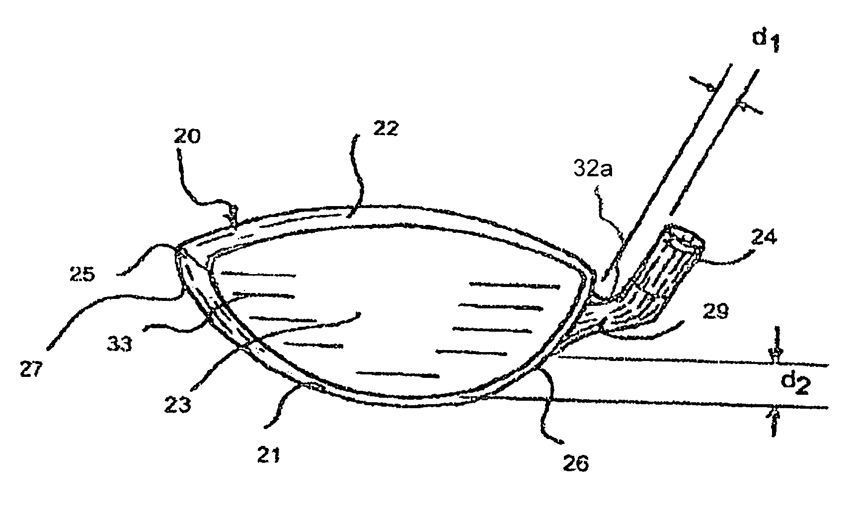 Clubhead with external hosel