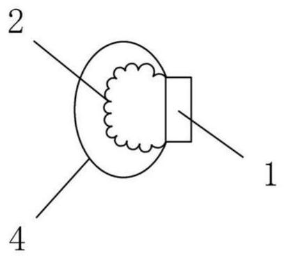 Thoracic wall sinus tract guide device for thoracic closed drainage