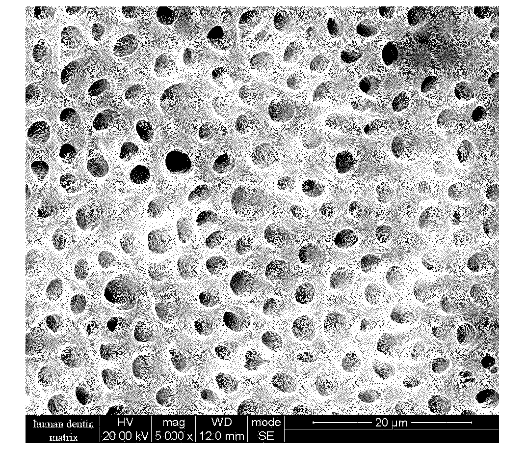 Manufacturing method of biological tooth root bracket material