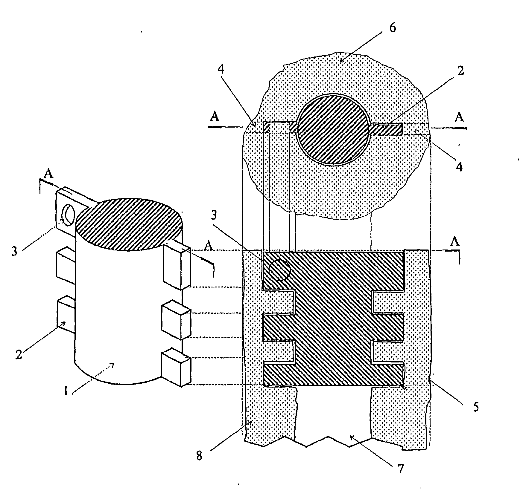 In-bone implantable shaft for prosthetic joints or for direct skeletal attachment of external limb prostheses and method of its installation