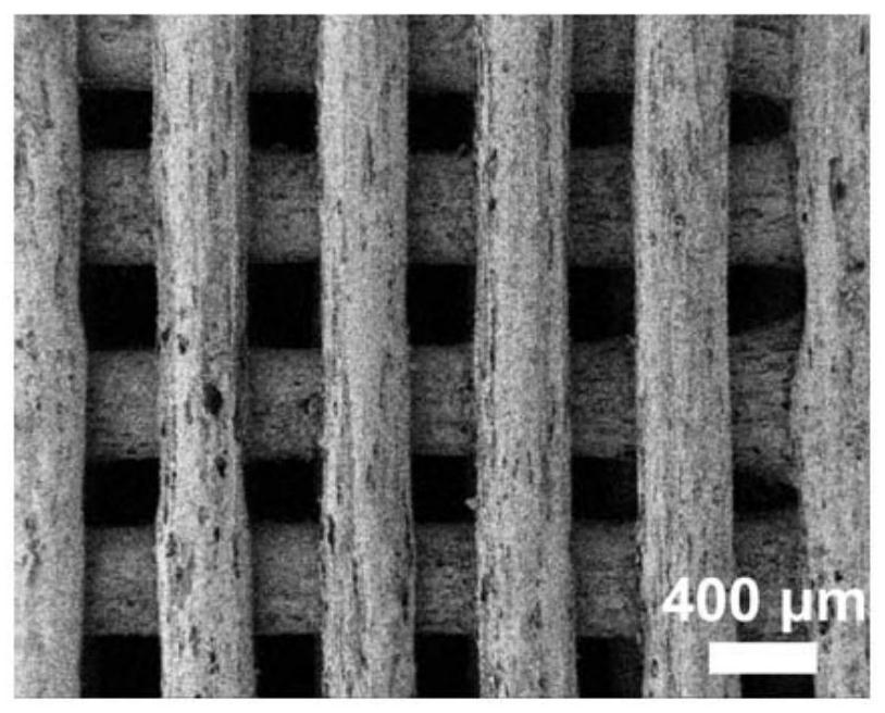 Bifunctional stent with anti-tumor and tissue defect repair effects and preparation method