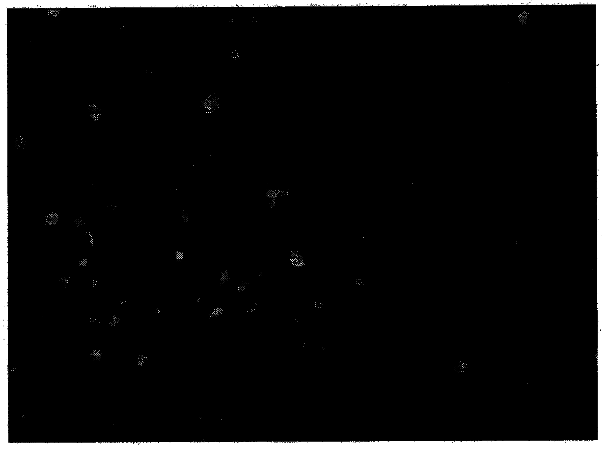 Method for separating and culturing primary human esophageal epithelial cells