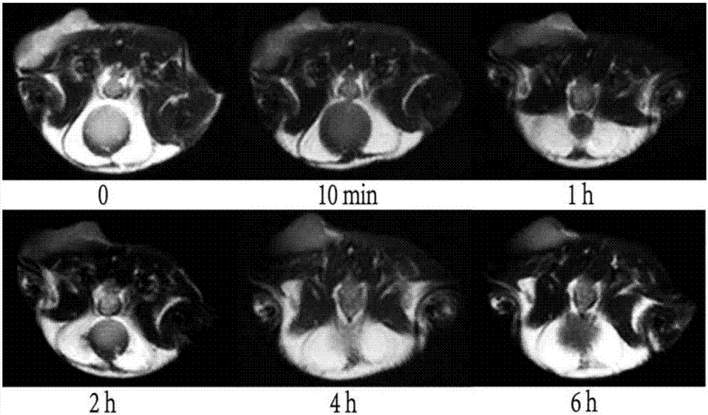 Magnetic resonance molecular probe for detecting early-stage hepatocellular carcinoma