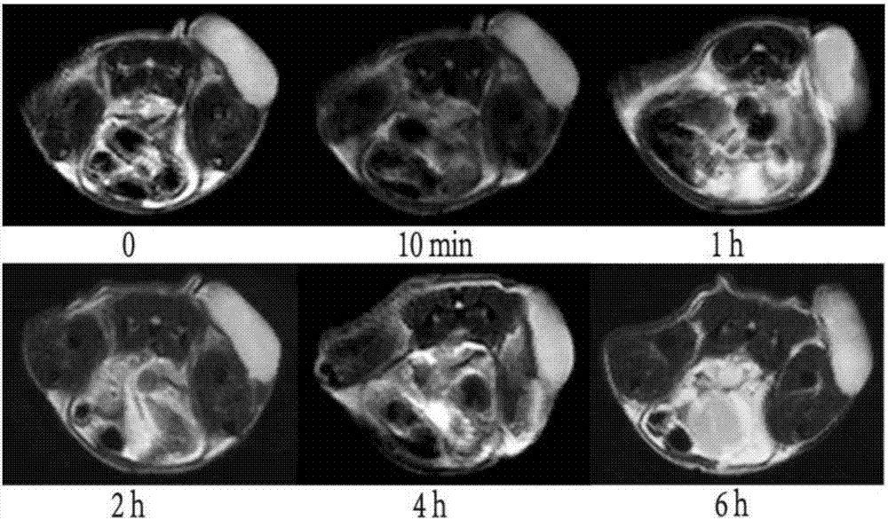 Magnetic resonance molecular probe for detecting early-stage hepatocellular carcinoma