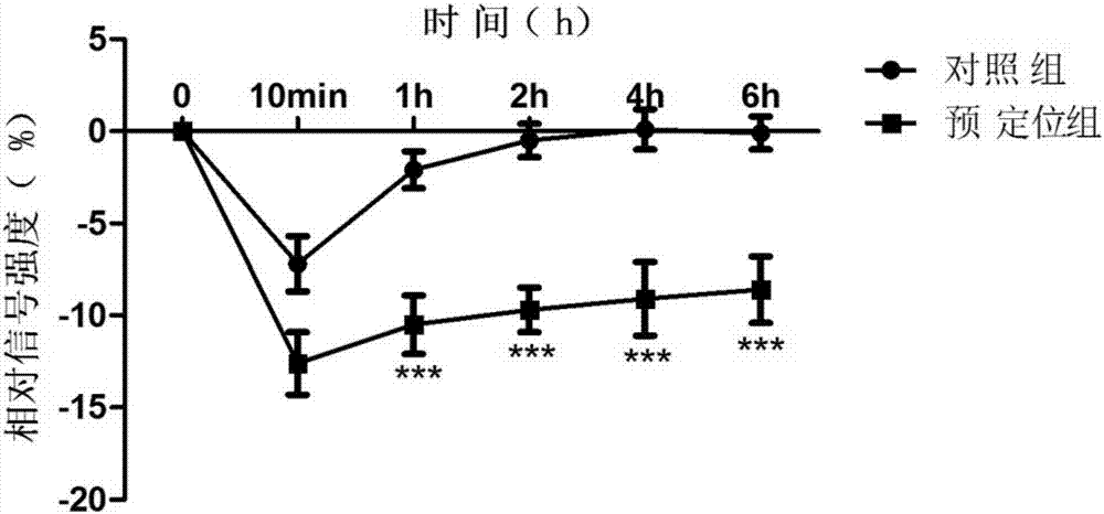 Magnetic resonance molecular probe for detecting early-stage hepatocellular carcinoma