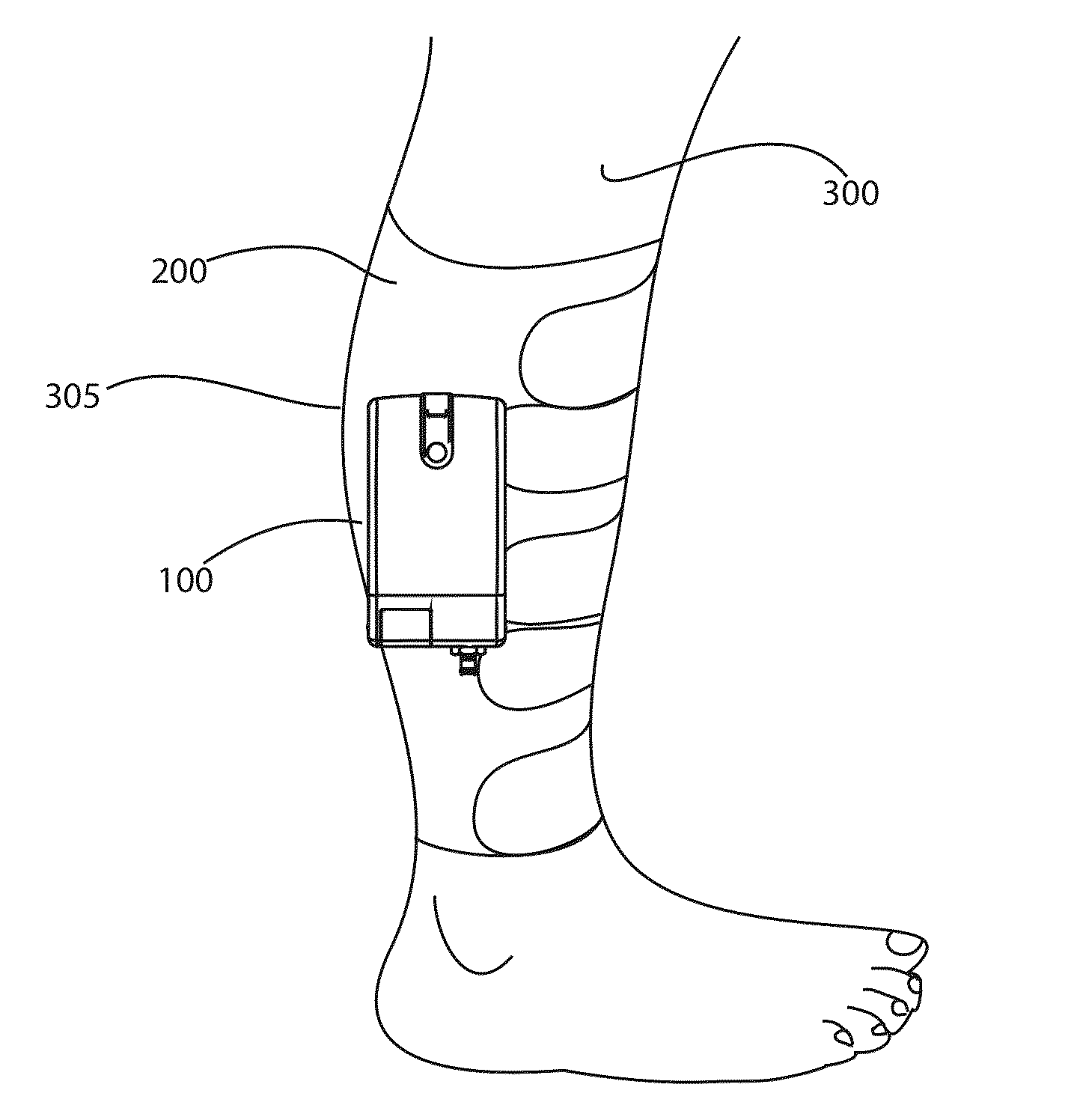 Portable intermittent pneumatic compression system