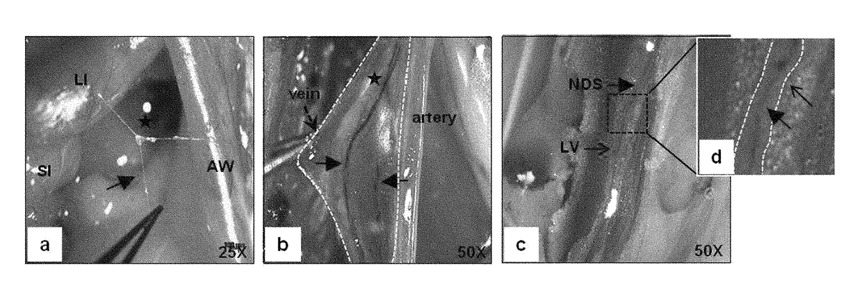 Har-nds-derived stem cells, method for separating same, and use thereof