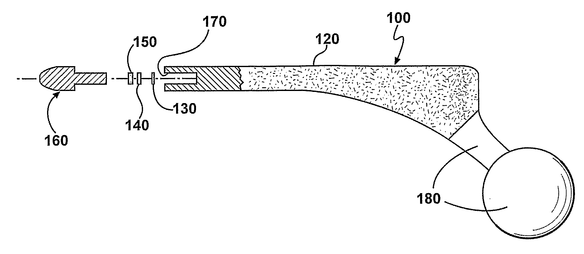 Prophylactic Bactericidal Implant